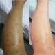 Antes e depois - Joana
