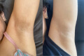 Antes e depois - Joyce Mendes