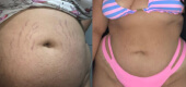 Antes e depois - Brenda Alves