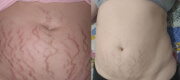 Antes e depois - Livia Ronquetti
