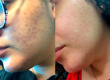 Antes e depois - Deyde Cristina