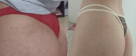 Antes e depois - Tânia Barbosa