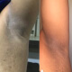 Antes e depois - Jean Moralles